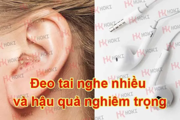 Đeo tai nghe nhiều và hậu quả nghiêm trọng