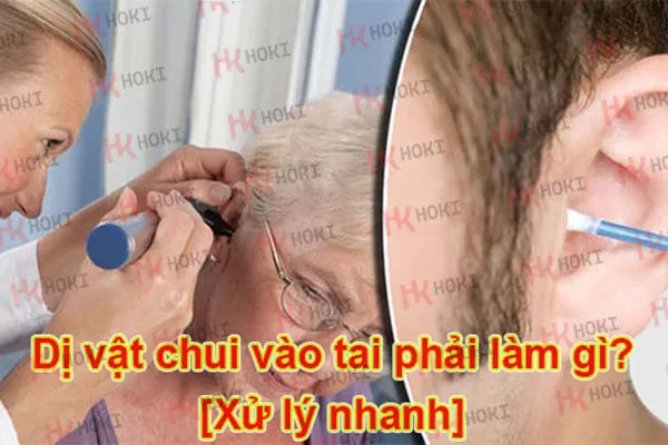 Dị vật chui vào tai phải làm gì? Cách xử lý nhanh