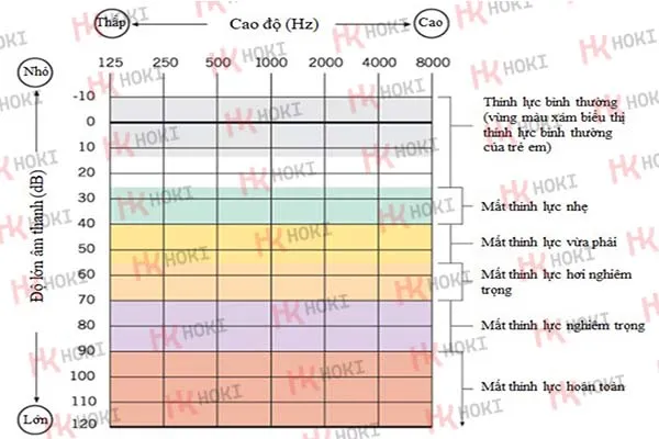 Đo thính lực đơn âm là gì? 5 bước quy trình