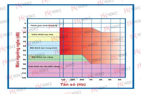 Đo thính lực giá bao nhiêu tiền?