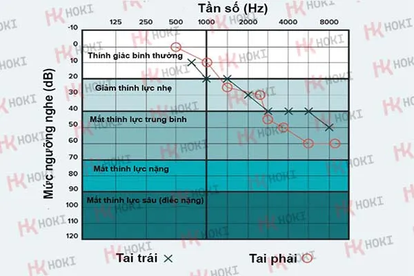 Ngưỡng nghe là gì? Tai người nghe được bao nhiêu dB