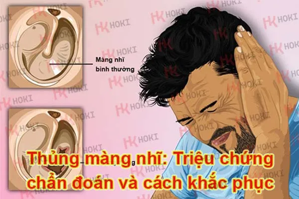 Thủng màng nhĩ: Triệu chứng, chẩn đoán và cách khắc phục