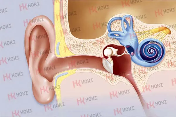 U dây thần kinh thính giác: Nguyên nhân, chẩn đoán và cách khắc phục