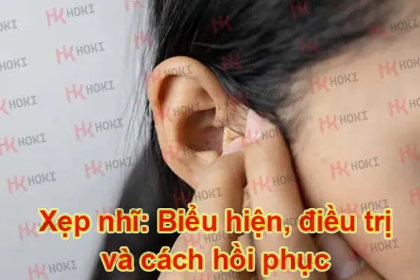 Xẹp nhĩ: Nguyên nhân,Biểu hiện và cách điều trị hồi phục