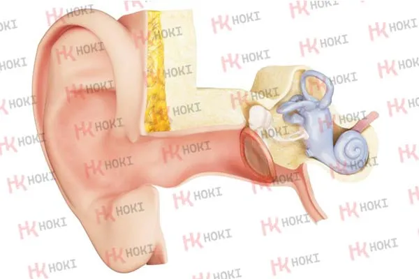 Xẹp nhĩ: Nguyên nhân,Biểu hiện và cách điều trị hồi phục